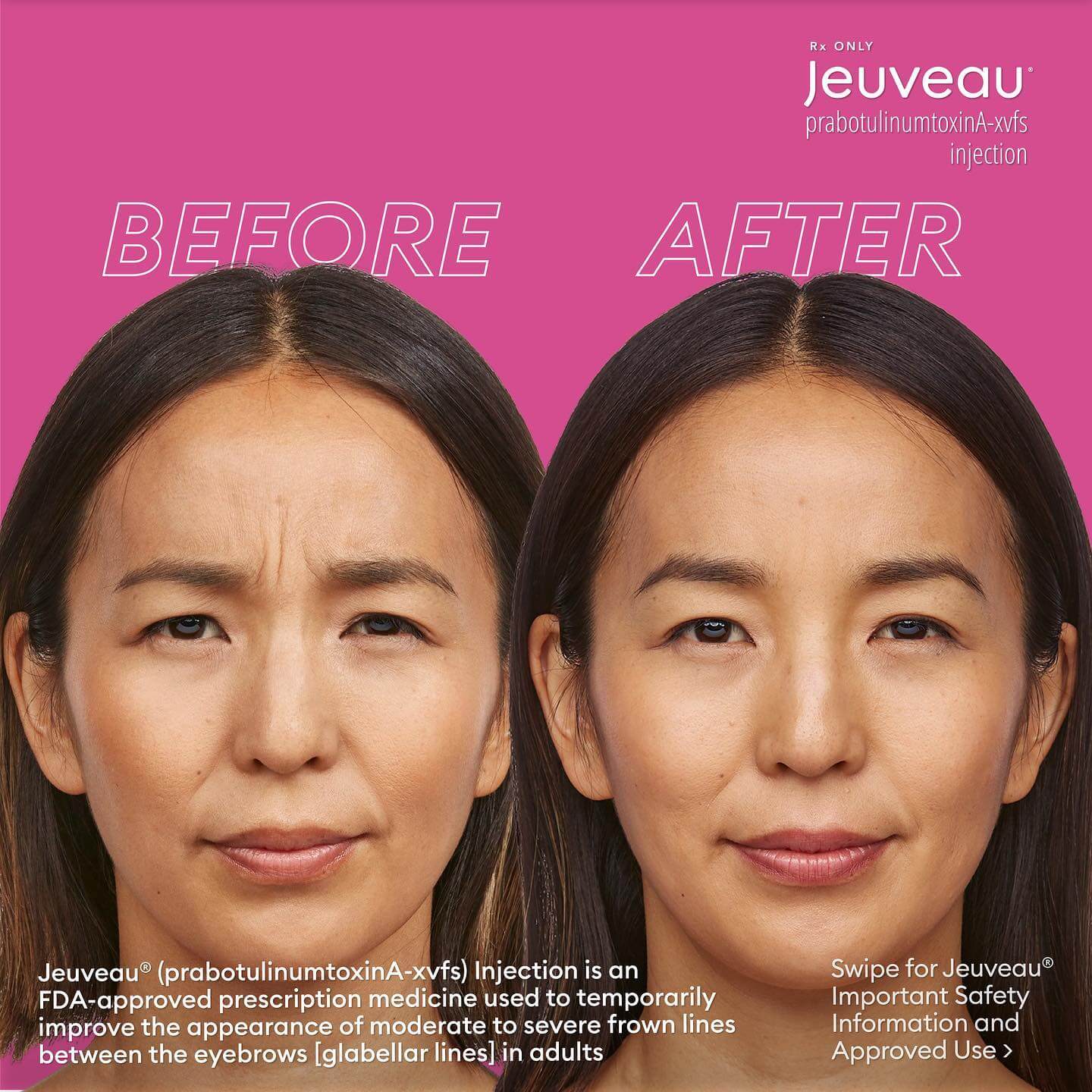 Jeuveau